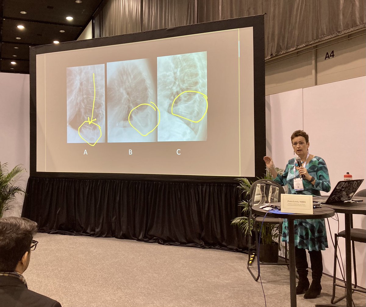 hrsugito's tweet photo. Couldn’t wish for a better ending for the med student sessions at #RSNA22💥

@petrasewingrad with another interactive radiology masterclass for #futureradres

That is all from #RSNAMSTF this year. We hope to see you next year!!
@RSNATrainees https://t.co/RqS9I28sTF