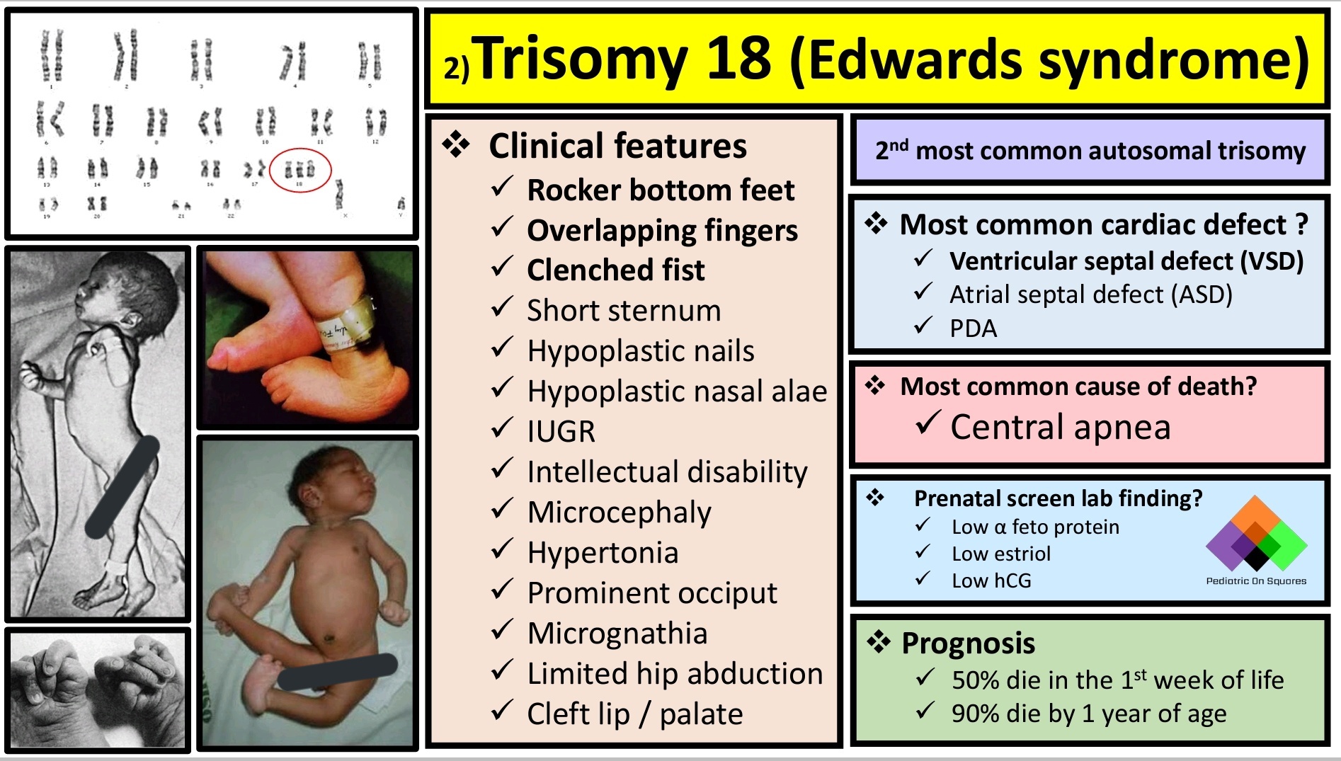 Double Trisomy