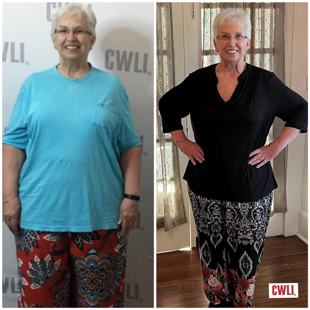 DrEddyClinic's tweet photo. RT @C_W_L_I: Impressive results in any season and at any age. We are impressed with Carol’s beautiful results. 56 lbs and counting.
We appreciate Carol’s beautiful attitude towards her journey. She inspired us week by week with her compliance.
#cwli #fu… https://t.co/N6Z5DEM3FF