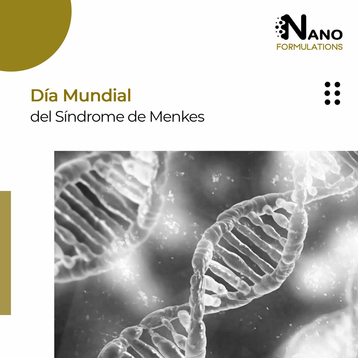nano_form's tweet photo. La enfermedad de Menkes es un trastorno que afecta a los niveles de cobre en el cuerpo. Se caracteriza por cabello ralo y ensortijado; retraso del crecimiento; y deterioro progresivo del sistema nervioso. https://t.co/yV9mVXuAUF