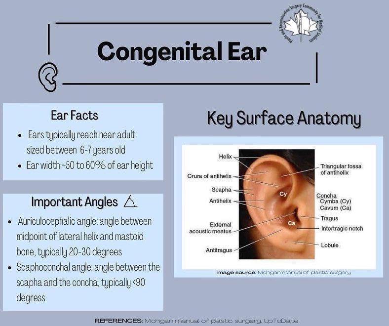prscommunity's tweet photo. ❗️weekly educational post❗️this week it's all about congenital ear 👂🏽 check out this post by our member Emily Burbidge! DM us with any topics you'd like to see https://t.co/Y6p3eCnrTy
