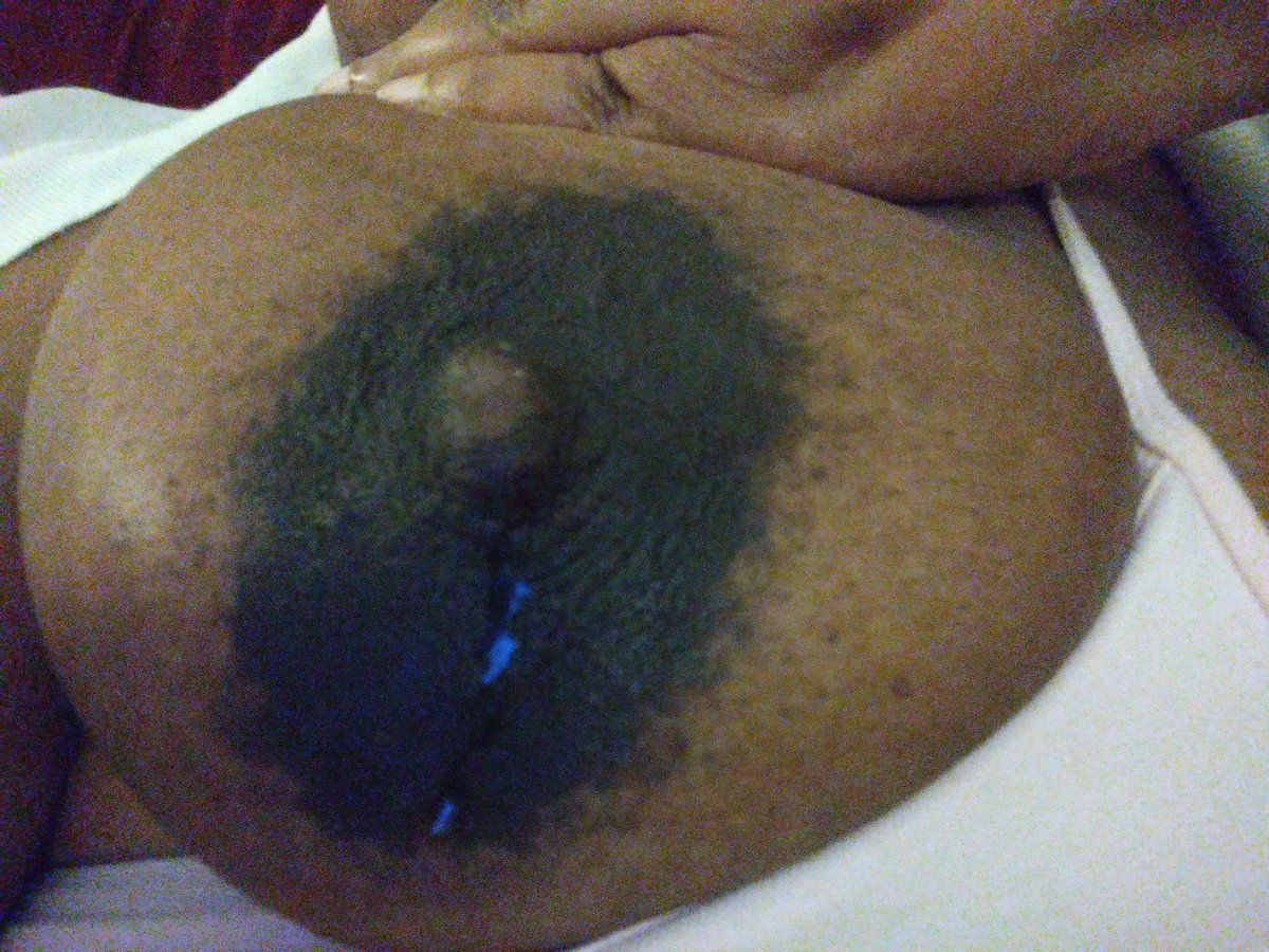 Post pump titty juice! I haven't pumped in almost a year! I'm shocked. No lactation meds #anr #abf #saggy #naturalbreasts #bigtitsmomِ #bigboobs #mommymilk #breastpumping