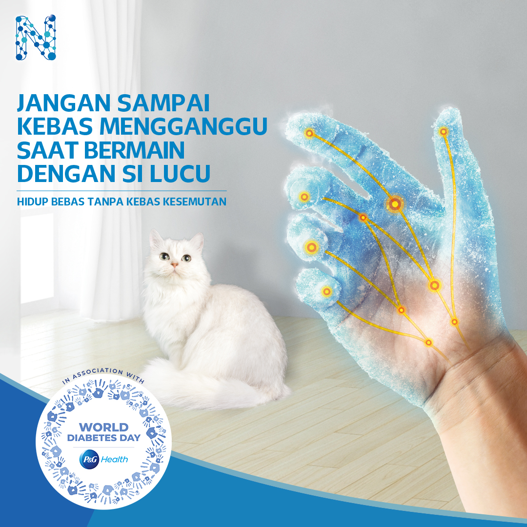 NeurobionID's tweet photo. Mengajak kucing peliharan bermain jadi salah satu cara buat jaga kesehatan dan kebahagian si lucu, lho. Hmm.. tapi kalau pemiliknya mengalami kebas begini, jadi enggak puas ya mainnya.

#Anti2k #Kebas #Kesemutan #SarafSehat #WorldDiabetesDay #HariDiabetesSedunia https://t.co/a98QmvcG86