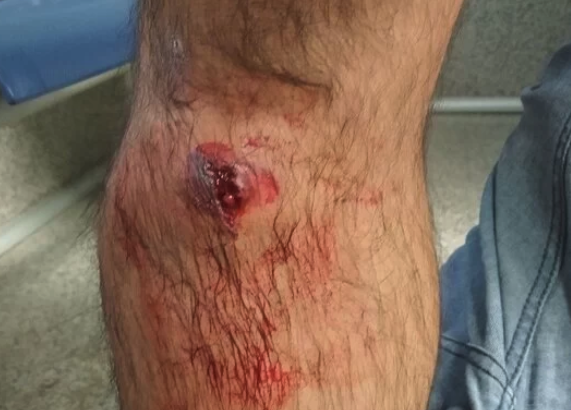 naiz_info's tweet photo. [AVANCE] Cuatro trasladados al hospital tras cargar la Ertzaintza contra un piquete del Metal en Arratia https://t.co/P5xh2krnBd https://t.co/xABFHBh0ue