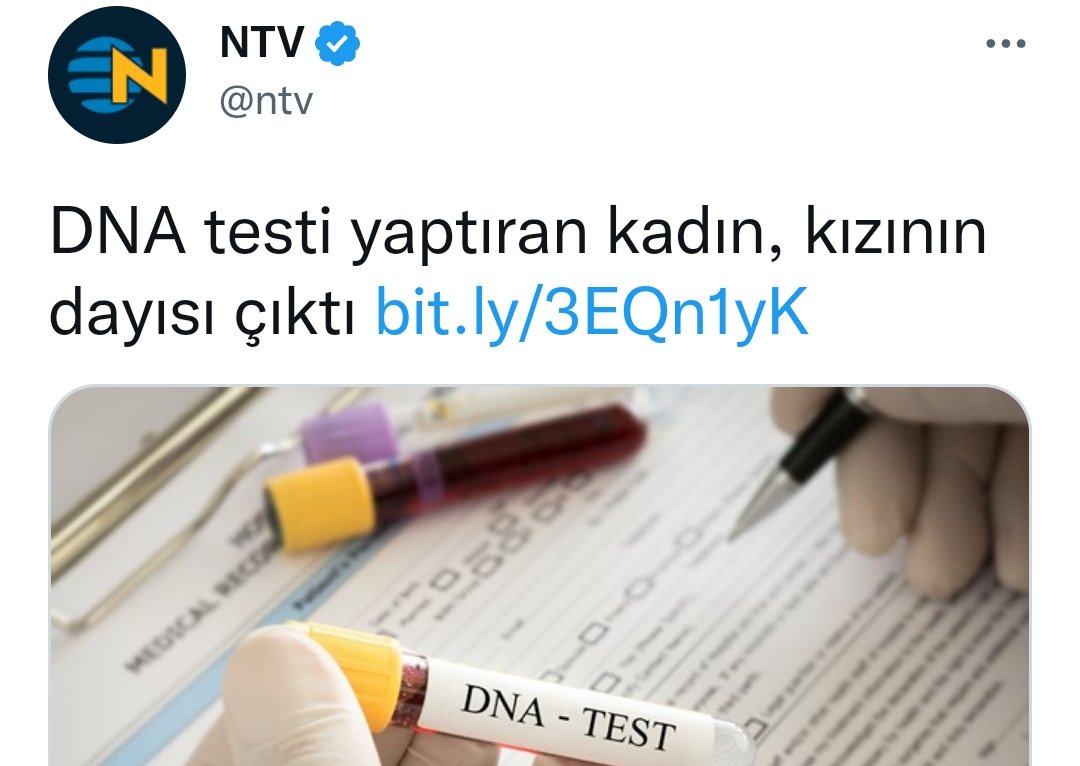 Aile hukuku 

Derste çözülen pratik: A, B'nin oğludur.

Sınavda sorulan pratik: