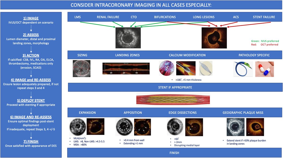 Congratulations to <a href="/mahz21/">Mahvash Zaman</a> for her first editorial: intravascular imaging in PCI ➡️ sciencedirect.com/science/articl… " The eye cannot appreciate what it cannot see—being blind should no longer be an excuse for not performing optimal PCI" <a href="/drandrewsharp/">Andrew Sharp</a>  <a href="/ziadalinyc/">Ziad Ali</a> <a href="/DrSaritaRao2/">Dr Sarita Rao</a> <a href="/ShrillaB/">Dr Shrilla Banerjee MD FRCP 💙</a>