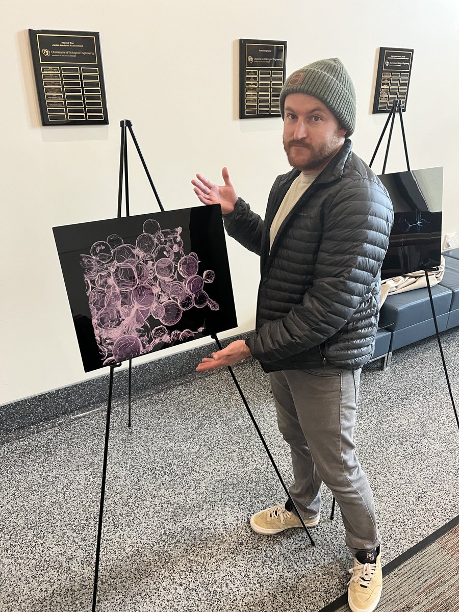 BurdickLab (@burdicklab) on Twitter photo Congrats <a href="/Fiber_Matt/">Matthew Davidson</a> for a 2nd place win in the CU Up Close Image Competition run through <a href="/BioFrontiers/">BioFrontiers 💻🦠🧬🧪🧫💉📊📓</a> Advanced Light Microscopy Core. Surprisingly, no fibers 🔬 Congrats <a href="/Fiber_Matt/">Matthew Davidson</a> for a 2nd place win in the CU Up Close Image Competition run through <a href="/BioFrontiers/">BioFrontiers 💻🦠🧬🧪🧫💉📊📓</a> Advanced Light Microscopy Core. Surprisingly, no fibers 🔬