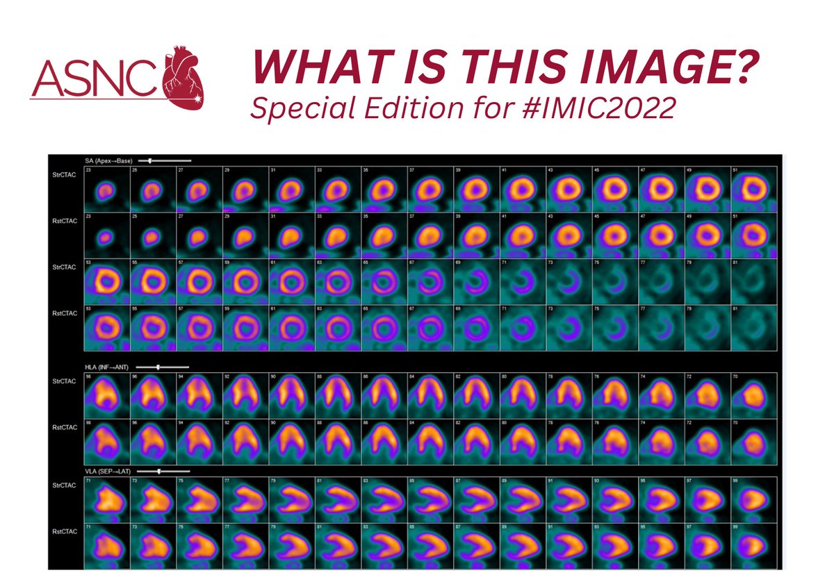 ASNC Society (@myasnc) on Twitter photo Can you correctly identify this image? Comment below⬇️
💥If you're an #IMIC2022 attendee, please let us know in your comment for your chance to win a <a href="/MyASNC/">ASNC Society</a> hat🧢!
Submit your response👇👇
#CVNuc Can you correctly identify this image? Comment below⬇️
💥If you're an #IMIC2022 attendee, please let us know in your comment for your chance to win a <a href="/MyASNC/">ASNC Society</a> hat🧢!
Submit your response👇👇
#CVNuc