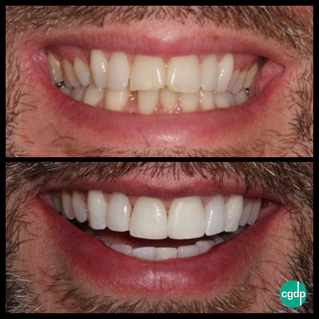 Covent Garden Dental tweet media