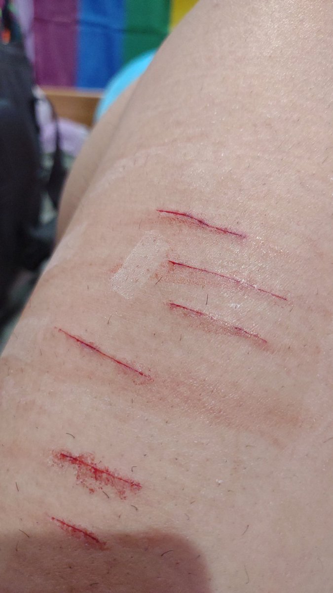 SelflessBabies's tweet photo. More epis top one is almost a styro 

Shtwt ouchietwt catscratchestwt styrotwt barcodetwt bloodtwt https://t.co/omWS2OZtQb