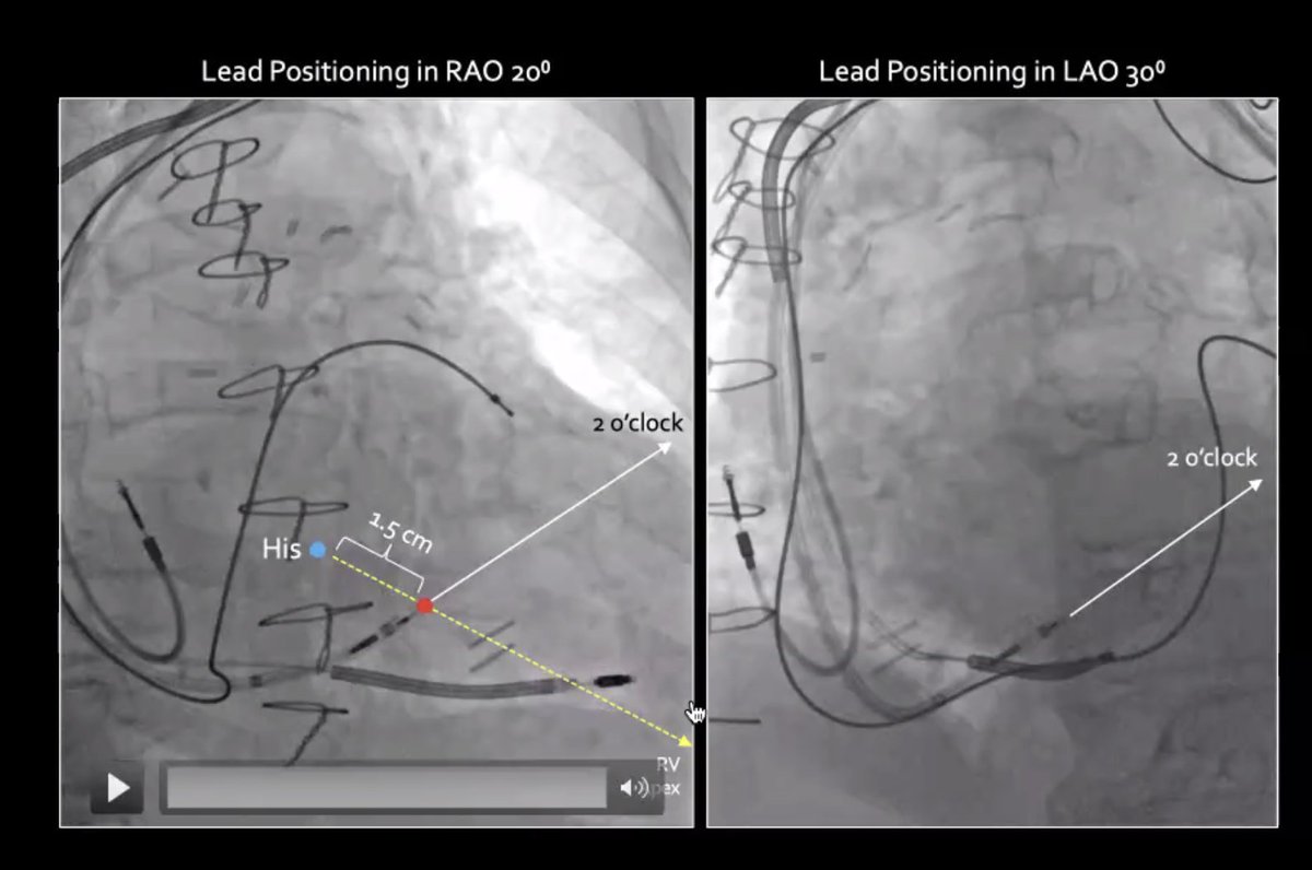 Edward J Schloss MD tweet media