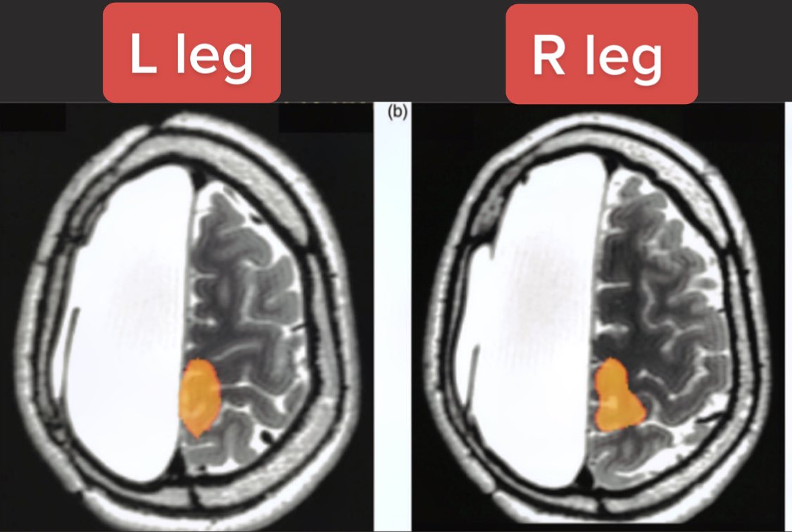 Avraham Z. Cooper, MD 🩺 tweet media