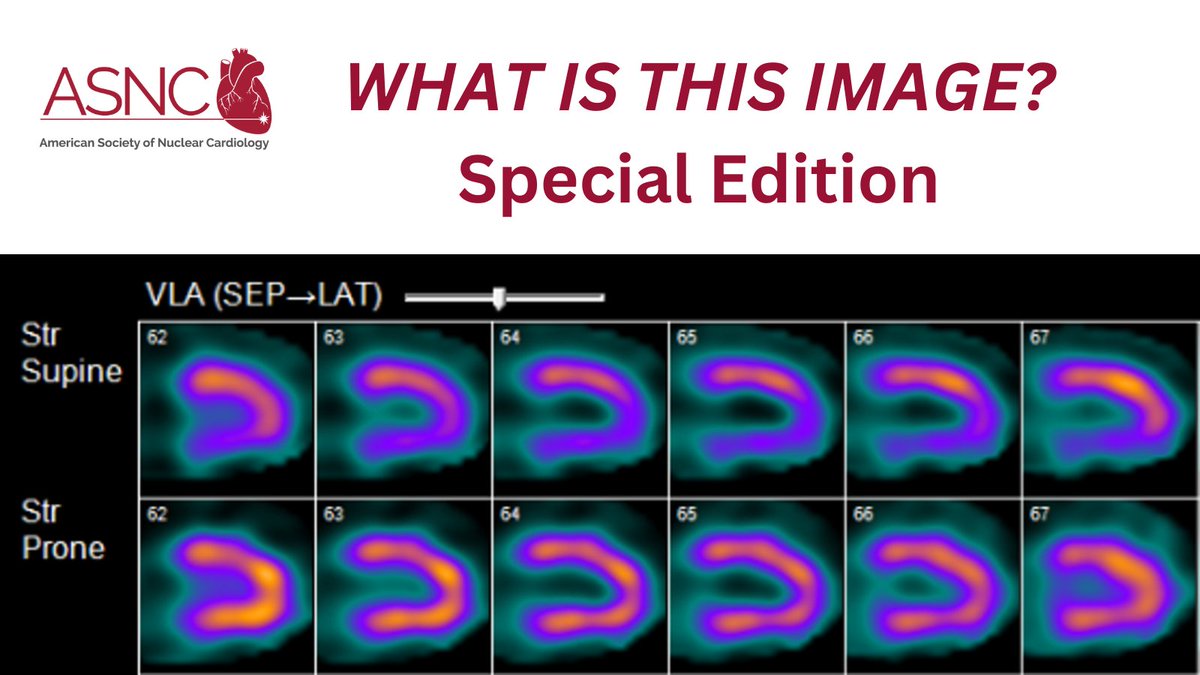 ASNC Society (@myasnc) on Twitter photo 💥Can you correctly identify this image? Tell us by entering a comment. If you're an #IAEA #IMIC attendee, be sure to tell us in your comment to be entered into our daily raffle to win a <a href="/MyASNC/">ASNC Society</a> hat🌟
Submit your response 👇and follow <a href="/MyASNC/">ASNC Society</a> to find out if you've won!
#CVNuc 💥Can you correctly identify this image? Tell us by entering a comment. If you're an #IAEA #IMIC attendee, be sure to tell us in your comment to be entered into our daily raffle to win a <a href="/MyASNC/">ASNC Society</a> hat🌟
Submit your response 👇and follow <a href="/MyASNC/">ASNC Society</a> to find out if you've won!
#CVNuc