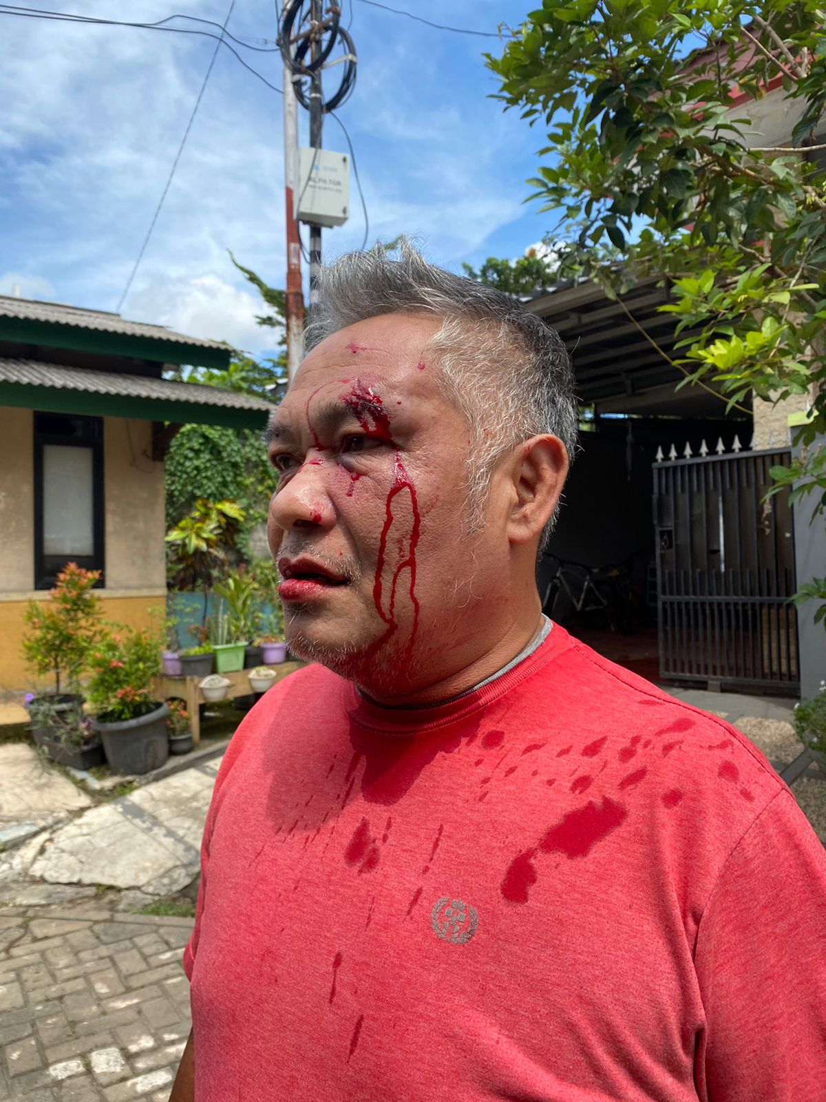 korban pratu syakban husein