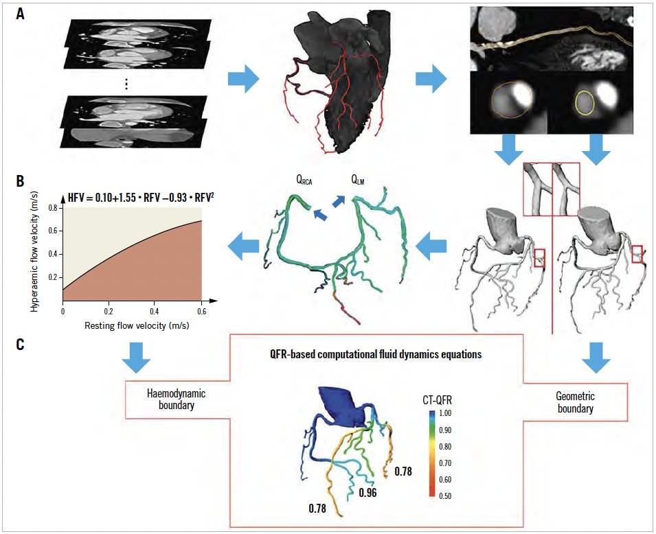 koshurkaul's tweet image. An important article, state of art review on Coronary Physiology from A to Z .

asiaintervention.org/article/corona… 
#asiaintervention #interventioncardiology #catheterisation #FFR #IVUS #OCT @Simone Fezzi @William wijns