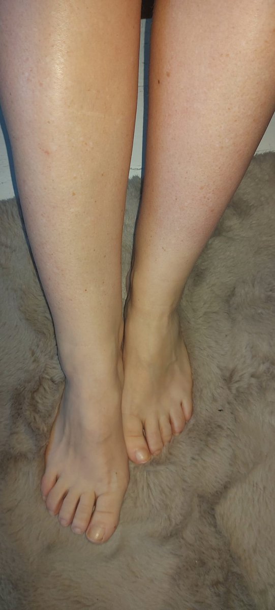 FeetDutch's tweet photo. Goodmorning #feetlovers #kissmyfeet The #nailpolish poll ended: the dark colors won.... Here a before and after... What do you love the most with or without nailpolish? https://t.co/Bb9MM6giNv