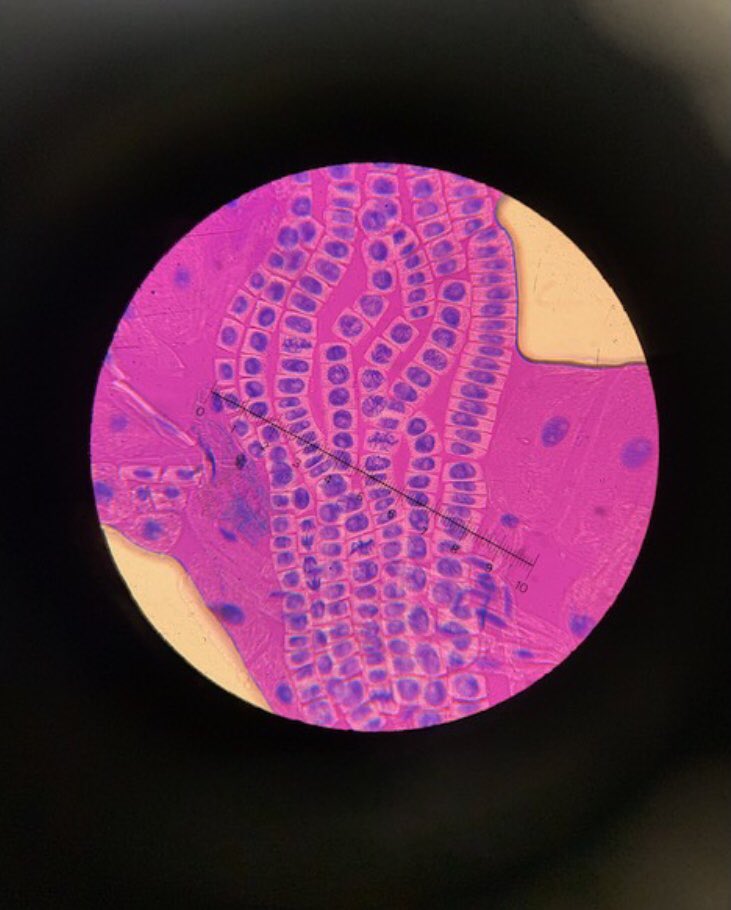 QCL_STEM's tweet image. Our senior biologists have been looking at mitosis down a 🔬. Can you spot the relevant cells?