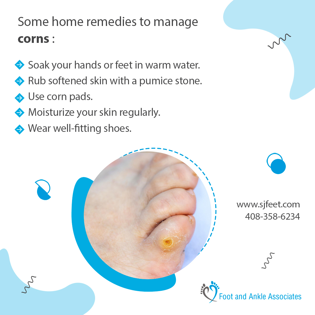 sjfeet's tweet photo. Corns are thick, hardened layers of skin that develop when the skin tries to protect itself against friction or pressure.
visit https://t.co/6Dfazt2nKi
#Treatment #Diabetes #Feet #Doctor #HealthyLife #FootTreatment #TreatingCommonFootProblemsLosAltos https://t.co/tRgriQMb8j