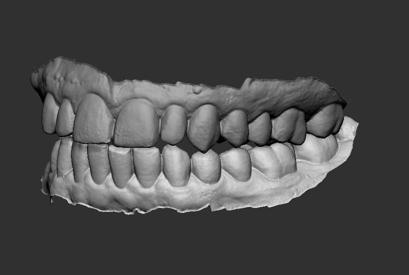 Henning Sanden (@henningsanden) on Twitter photo I went to the dentist today and they 3D scanned my teeth to check them. Naturally I asked for the file. 
Twitter - meet my teeth in ZBrush
We truly live in the future. I went to the dentist today and they 3D scanned my teeth to check them. Naturally I asked for the file. 
Twitter - meet my teeth in ZBrush
We truly live in the future.