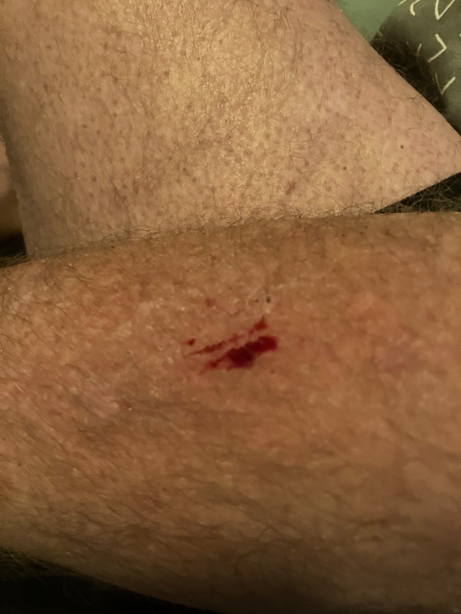 gregsnelson's tweet image. YOU ARE GOING TO JAIL BITCH, PLEASE GET ROSIE &amp;amp; SETH SS # THEY PULLED GUN AT ME @HiltonHotels CAPITAL ASK TOM KENNEDY AND JESSE JANE DUFF @HiltonHonors @TheView @andersoncooper @HillaryClinton @fbi @DHSgov @ATFHQ @amyklobuchar