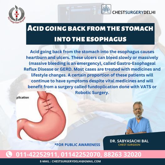 DrSBal's tweet photo. Acid going back from the stomach into the Esophagus
For more info
Call @ 01142252911
Institute of Chest Surgery and Chest Surgical Oncology, New Delhi
#Drbal #oncology #pulmonologist #healthcare #chestsurgeon #health #Esophagus #Esophagussurvivor #Esophagusproblems https://t.co/Iq0n9hYyZ1