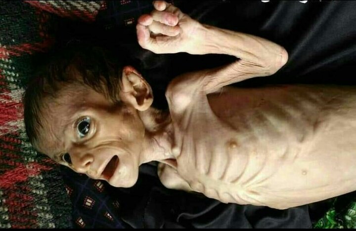 AlmaqtariFatima's tweet photo. A picture can tell you everything, silence is shame.
quoted
#Anonymous
#OpYemen

Donate now at 👇
https://t.co/wLeXDYTX8W https://t.co/xjn5c7cb4z