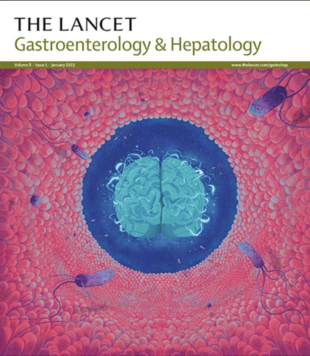 🔔 The ESPAC5 is out! 

Immediate surgery 🤜🤛 Neoadjuvant chemo for BR-PDAC

🤯 Difficult recruitment (90/470 screened)
🪡 Resection rate similar
💉 Chemo better survival, no difference btw Gem Cap vs. Folfirinox   

🧐 The END of upfront surgery for BR?

thelancet.com/journals/langa…