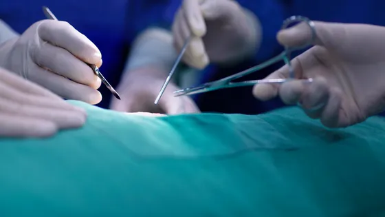 ScienceCQFD's tweet photo. [#Podcast] 24/11 > Une greffe de nez réalisée à partir d'un biomatériau imprimé en 3D https://t.co/6SpusAzlvd un #JournalDesSciences à (ré)écouter via @franceculture #ScienceCQFD https://t.co/k4rl0JQXVp