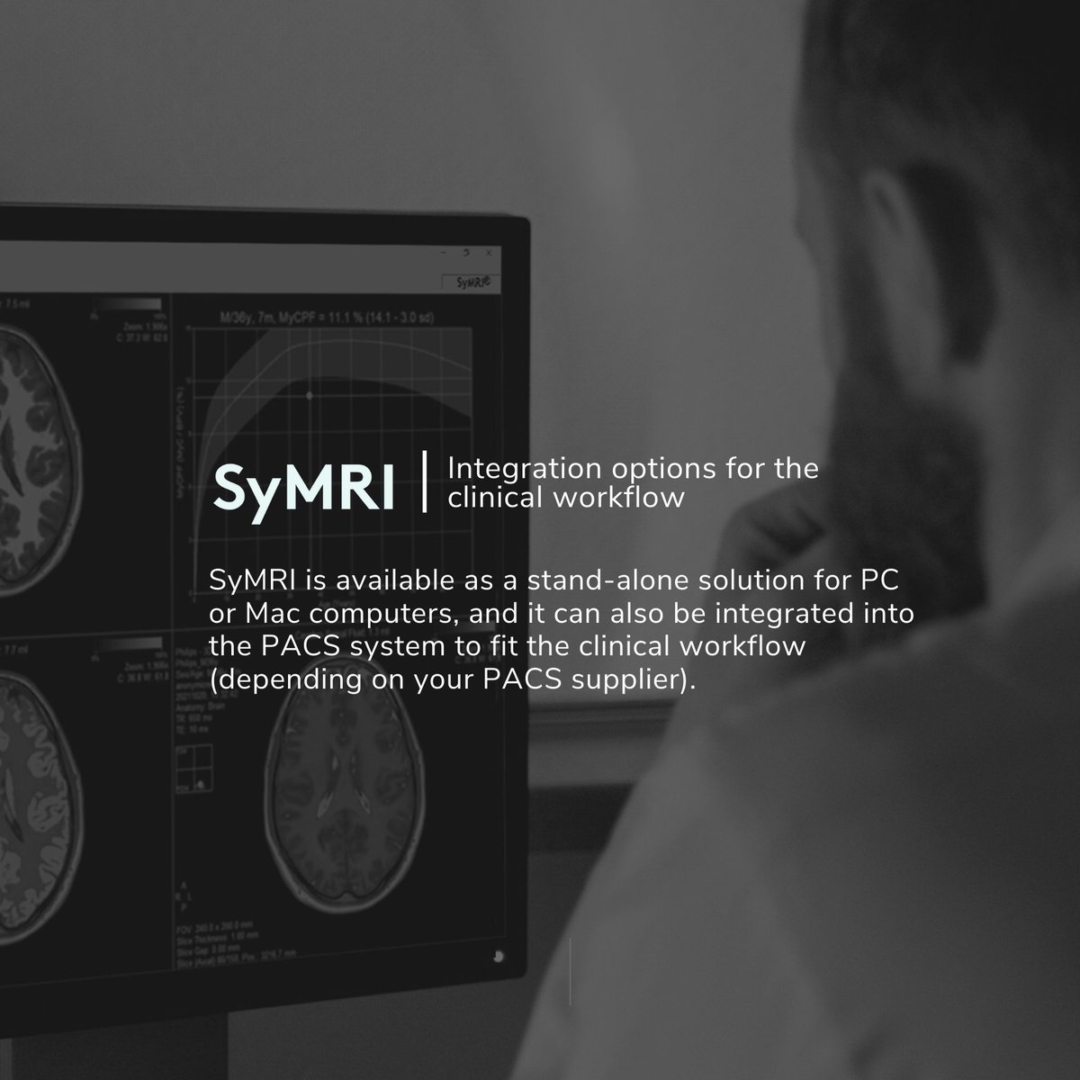 Synthetic_MR's tweet photo. SyMRI NEURO can be integrated into the PACS system to fit your clinical workflow. With SyConnect the dataflow reduces the need for manual processing and transports data without human interference between the scanner and the reading station.
#symri #mriimaging #neurology https://t.co/0raQjH6jyV