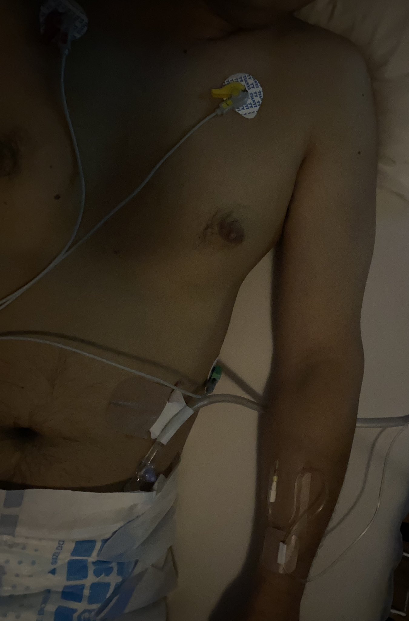 婦人科診察台　医療プレイ　浣腸 
