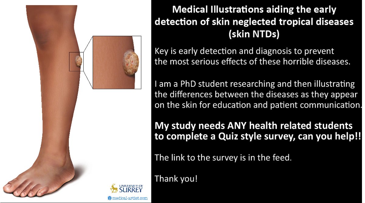 joannaculley's tweet photo. Quiz Style Survey – can you complete it?
https://t.co/tvVNItkSWJ I need students studying ANY health related subject to complete a quiz style survey
#pharmacystudent #nursingstudent #dentistrystudent #midwiferystudent #physiotherapist #nursingstudent #paramedicstudent #hcastudent https://t.co/aN5pOSlLpM