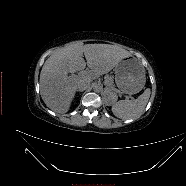 Brown Hospital Medicine on Twitter "A 30 year old woman presented with