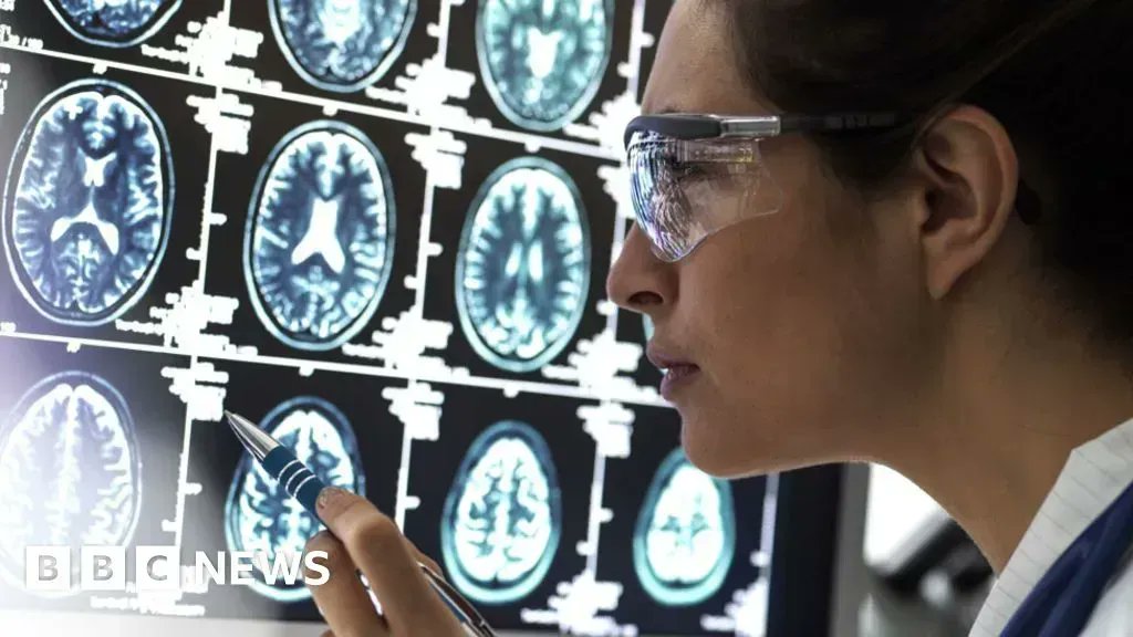 BioticaHealth's tweet photo. Good news in the Fight Against Alzheimer's front. https://t.co/6XOnuH3jpJ via @BBCNews 
#Alzheimers #AlzheimersDisease #MedTwitter #healthcare https://t.co/qZdgGBq4Cn