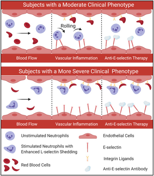 UAGurkan's tweet photo. New paper in Biosensors &amp; Bioelectronics: "A microfluidic device for assessment of E-selectin-mediated neutrophil recruitment to inflamed endothelium and prediction of therapeutic response in sickle cell disease." support: @nih_nhlbi 👇 https://t.co/qLpITpind4 https://t.co/vkQUWp8HFr