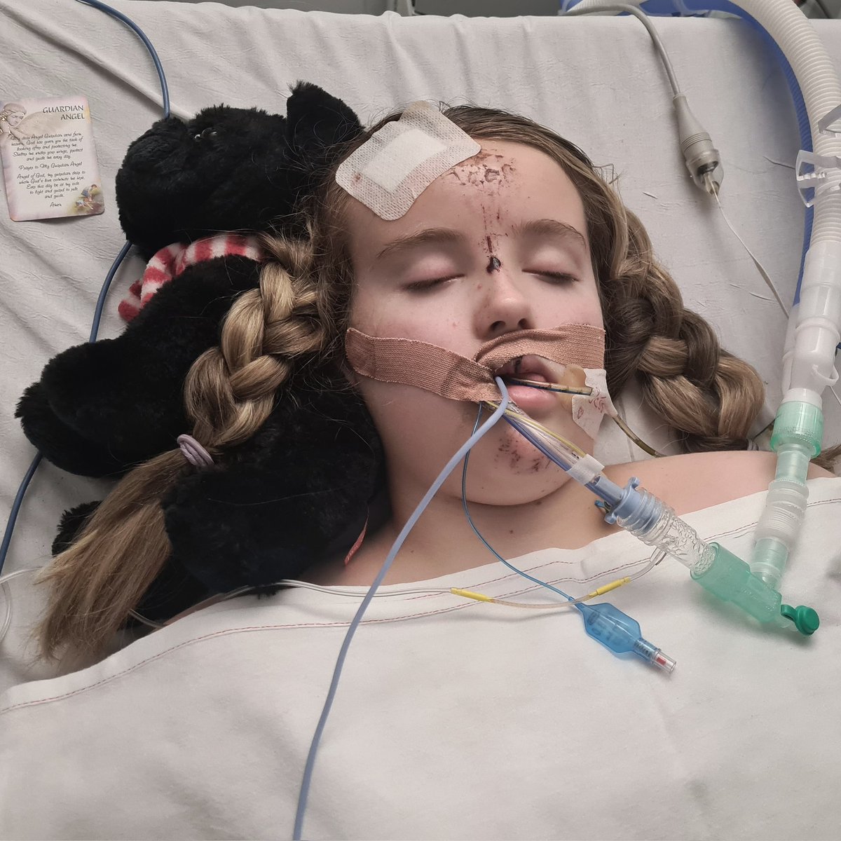 WallKathryne's tweet photo. @JasonManford Im running a campaign to change driving laws  so vehicles have to wait behind a stopped school bus to try and keep our children safer. 
My daughter was ran over. I dont want this to happen to another child again. Can you help? 
https://t.co/AU96RF8aEV https://t.co/b4afNsj29Y