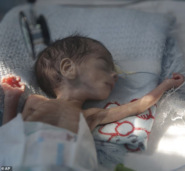 LPNebraska's tweet photo. Call 1-833-STOP-WAR to connect automatically to senators @SenSasse and @SenatorFischer 

They vote tonight on S.J. Res. 56, limiting Biden's feckless administration on the capricious conflict your tax dollars have sponsored in Yemen.
@LPNational @misesne @SarpyLP https://t.co/8qx9mTY20V