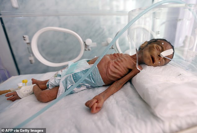 LPNebraska's tweet photo. Call 1-833-STOP-WAR to connect automatically to senators @SenSasse and @SenatorFischer 

They vote tonight on S.J. Res. 56, limiting Biden's feckless administration on the capricious conflict your tax dollars have sponsored in Yemen.
@LPNational @misesne @SarpyLP https://t.co/8qx9mTY20V