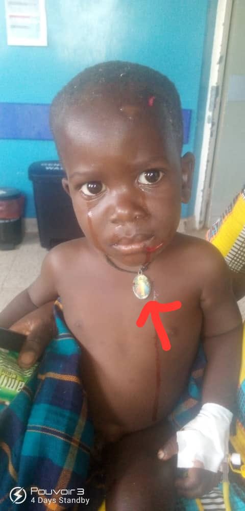 Collinsongok123's tweet photo. This young boy at 3:00pm yesterday 11th Dec in Katwe Village in Kasese, was swallowed by a hippo 🦛 in their compound,After like 5 minutes it vomited him out .The mother rushed him to the hospital think’n he was dead, there he is alive &amp; kicking.Source, Neighbors to the Family. https://t.co/Ep3FA5gjFL