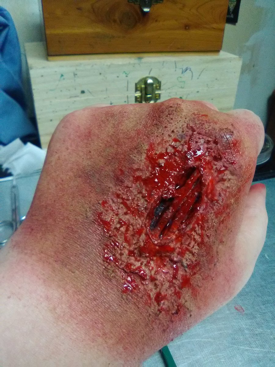 PileOfCigAsh's tweet photo. Was messing around last night practicing. Something tells me i'm gonna get a content warning on this one too. #horror #zombiebite #makeup https://t.co/aJXuSVKk1f