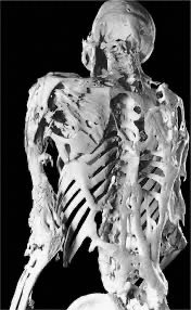 Oren Gottfried, MD tweet media