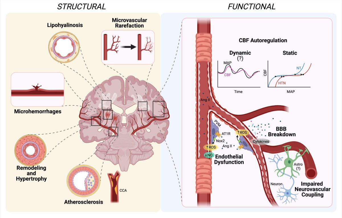 ON THE COVER: REVIEW - Hypertension, Neurovascular Dysfunction, and Cognitive Impairment ahajrnls.org/3FOr9Bf