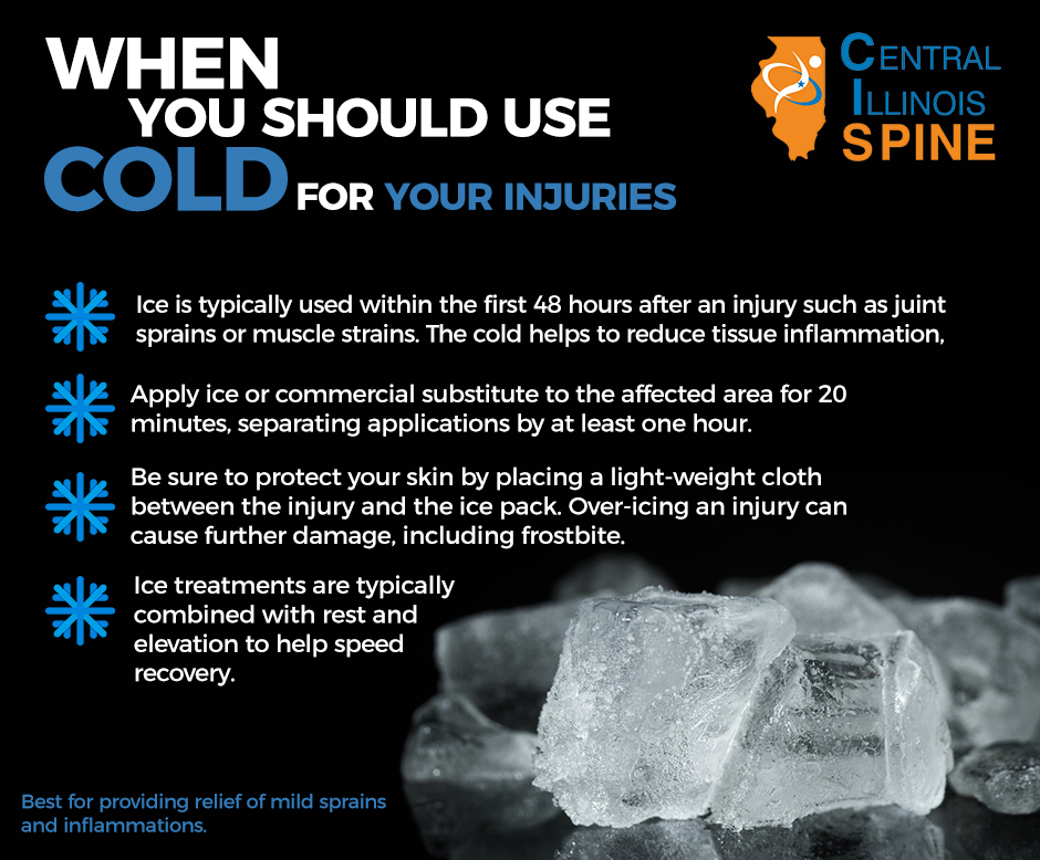 DrDecompression's tweet image. Do you know when you need to be icing?