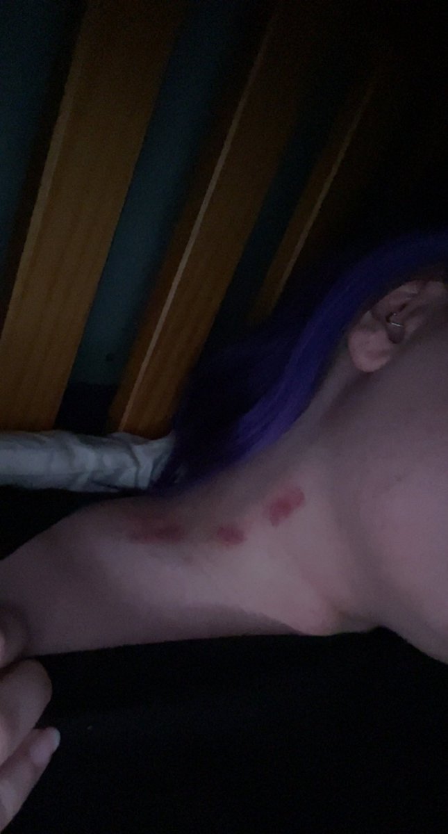 Bewitchingbabe1's tweet photo. More please 😏😏 #hickeys #nsfwtwt #submissive #brat #masochist https://t.co/M0MqLxSflB