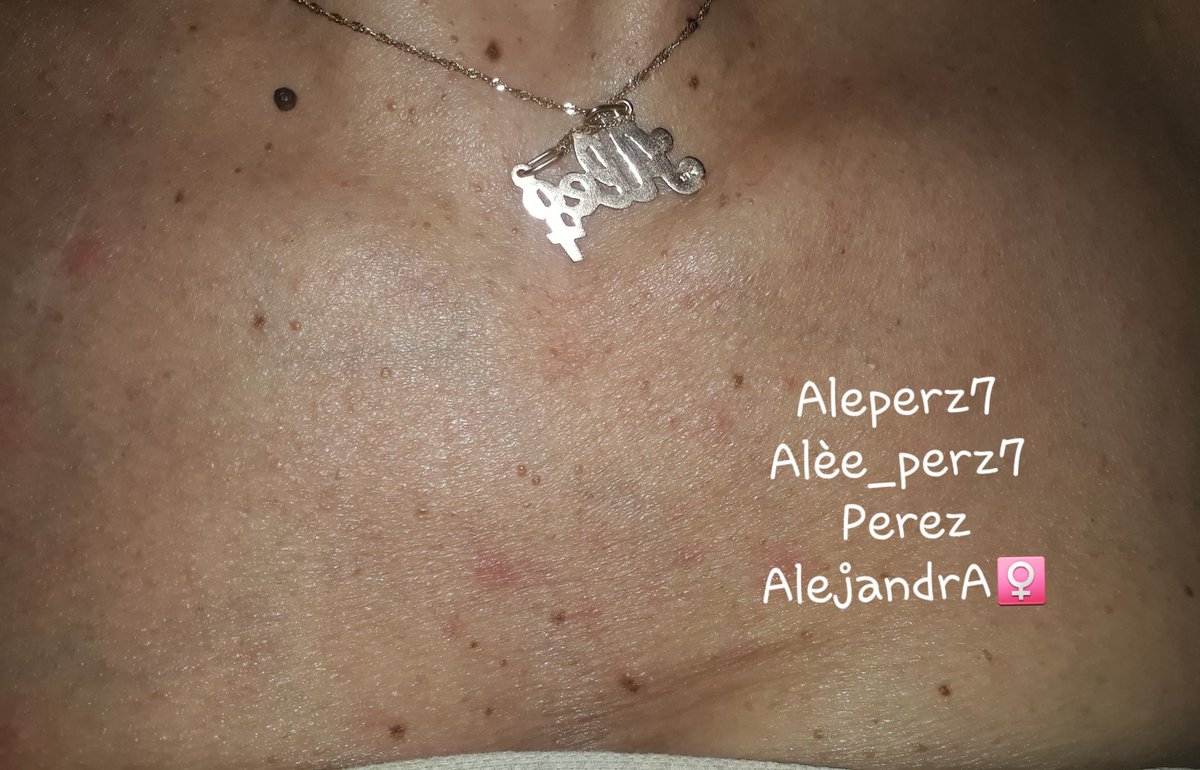 AlePerz7's tweet photo. Aleperz7
Alèe_perz7 
Perez AlejandrA♀️🧚🏼‍♀️21.11.65
#MiBlasAlit🐕♂ 5B #NvaCba #CórdobaCapital #Argentina🇦🇷
#2022 https://t.co/GEBoSQ68yu