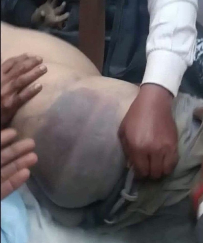 gyanu999's tweet photo. कानपुर के बलवंत सेंगर का कुसूर क्या था जो उसे पीटपीटकर @KanpurPolice ने निर्जीव देह में तब्दील कर दिया? खाकी के भेष में छिपे हत्यारों-दरिंदों का कोई इलाज हो सकेगा क्या?? https://t.co/Bm7vKS12NA