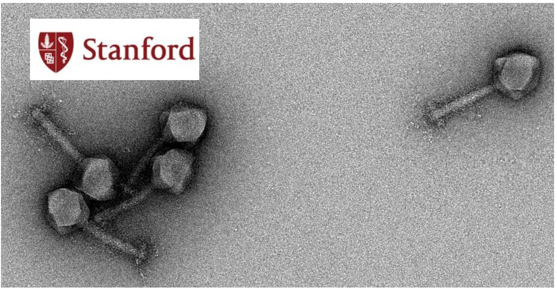 Paul Bollyky (@bollyky) on Twitter photo The Bollyky lab is hiring! We're looking for post-docs interested in studying bacteriophages in the human body to come join us at <a href="/StanfordMed/">Stanford Medicine</a>. Please DM if interested. The Bollyky lab is hiring! We're looking for post-docs interested in studying bacteriophages in the human body to come join us at <a href="/StanfordMed/">Stanford Medicine</a>. Please DM if interested.