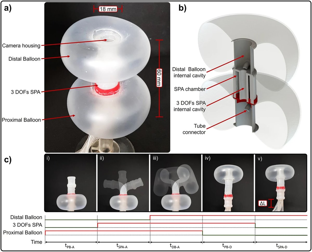 AGA_TIGE's tweet photo. Current technological advancements in flexible #roboticendoscopy enhance the accuracy of operations, and reduce patient discomfort by reducing the invasiveness and duration of #endoscopicprocedures https://t.co/LtF1pC19NY @VinayChandraMD @EHolzwanger @AbiMansourMD https://t.co/fEEqzjw4Rs