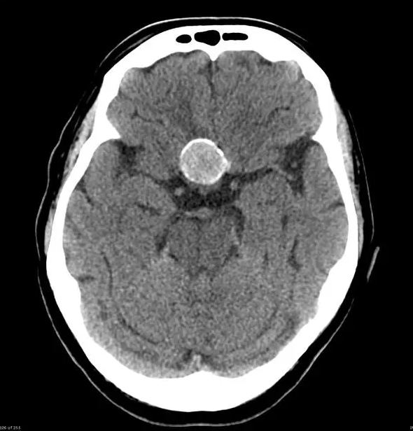 radRounds Radiology Network tweet media