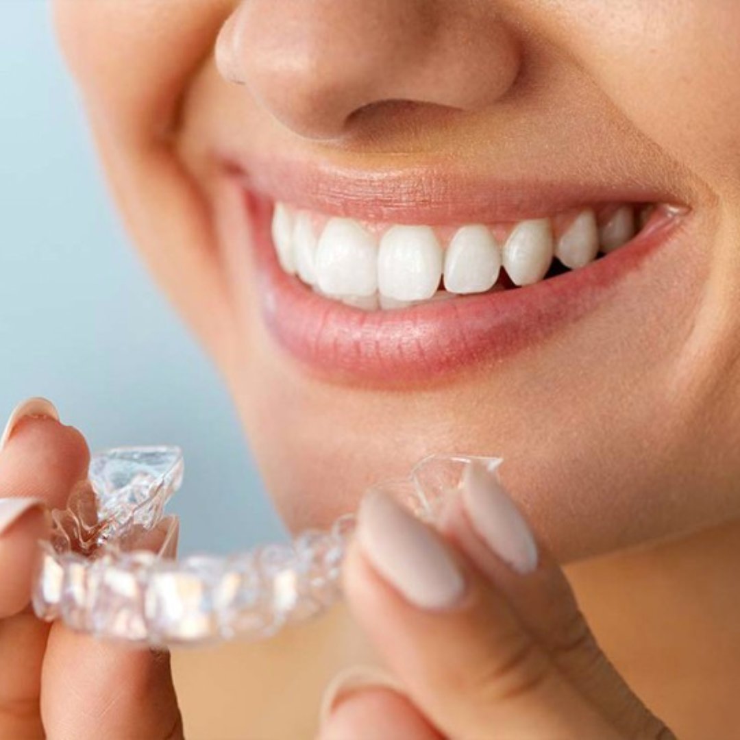 Элайнеры Invisalign
