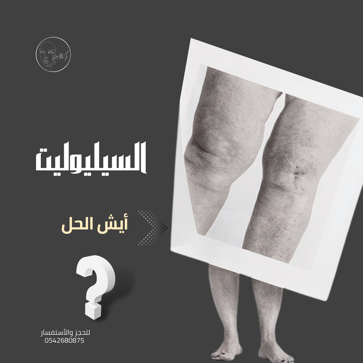 drmaljudaibi's tweet photo. ماهو السيليوليت أولا لنتعرف بعدها كيف يمكن التعامل معه وعلاجه اوتحسين مظهره ؟؟
السيلوليت هو تجعد في شكل الجلد حيث أن الدهون  تظهر بشكل غير مستو نتيجة ضغطها على الأنسجة الضامه وبذلك يتكون السيلوليت. السيلوليت هو مشكلة جمالية من الدرجة الأولى ولا يعبر عن أي مشكلة صحية #السيلوليت https://t.co/t7B0rUga0m